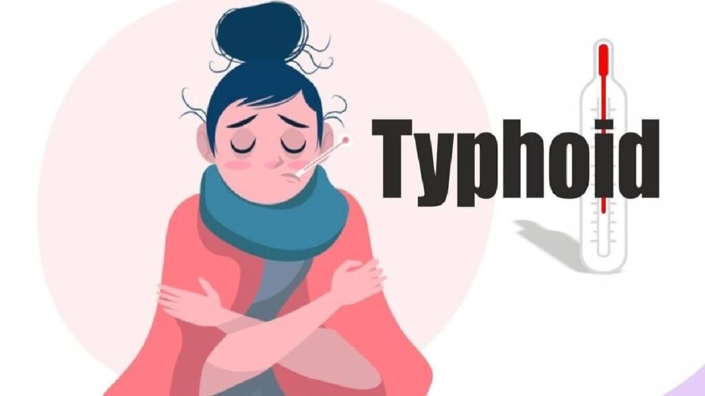 Typhoid Fever